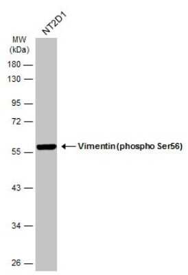 Western Blot: Vimentin [p Ser56] Antibody [NBP3-13119]